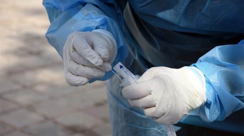 Δωρεάν (Rapid Test) αύριο Δευτέρα 11 Απριλίου στο Δομοκό. Δωρεάν (Rapid Test) αύριο Δευτέρα 11 Απριλίου στο Δομοκό.