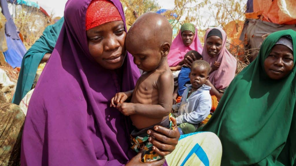 Έρευνα της UNICEF γροθιά στο στομάχι: Στη Σομαλία ένα παιδί κάθε ένα λεπτό μπαίνει στο νοσοκομείο με υποσιτισμό