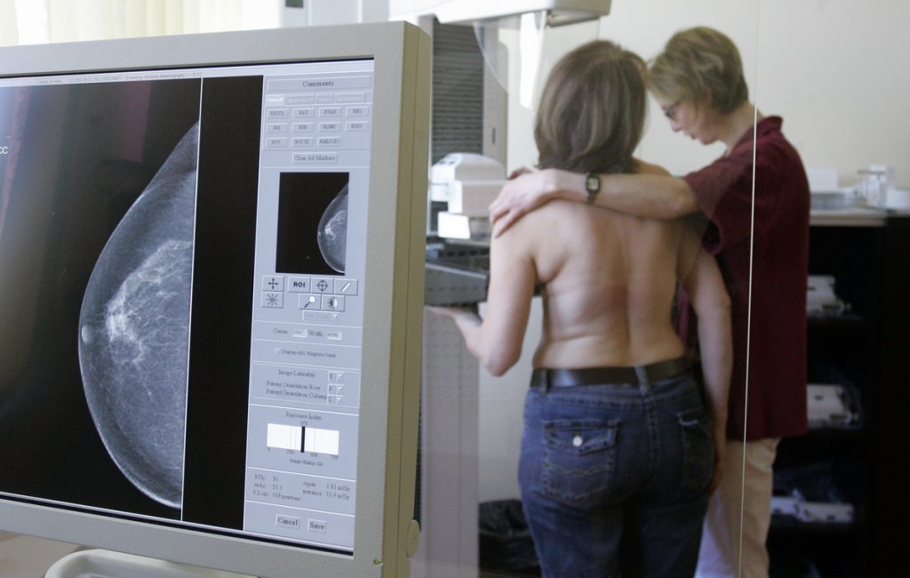 Έκαναν σε 55χρονη νοσηλεύτρια διπλή μαστεκτομή έπειτα από λανθασμένη διάγνωση για καρκίνο