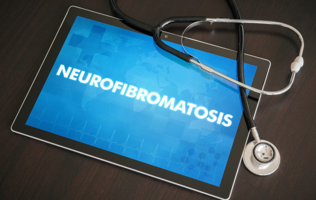 Πρόεδρος της NF Patients United για τη νευροϊνωμάτωση: Δεν είστε μόνοι και η φωνή σας έχει σημασία